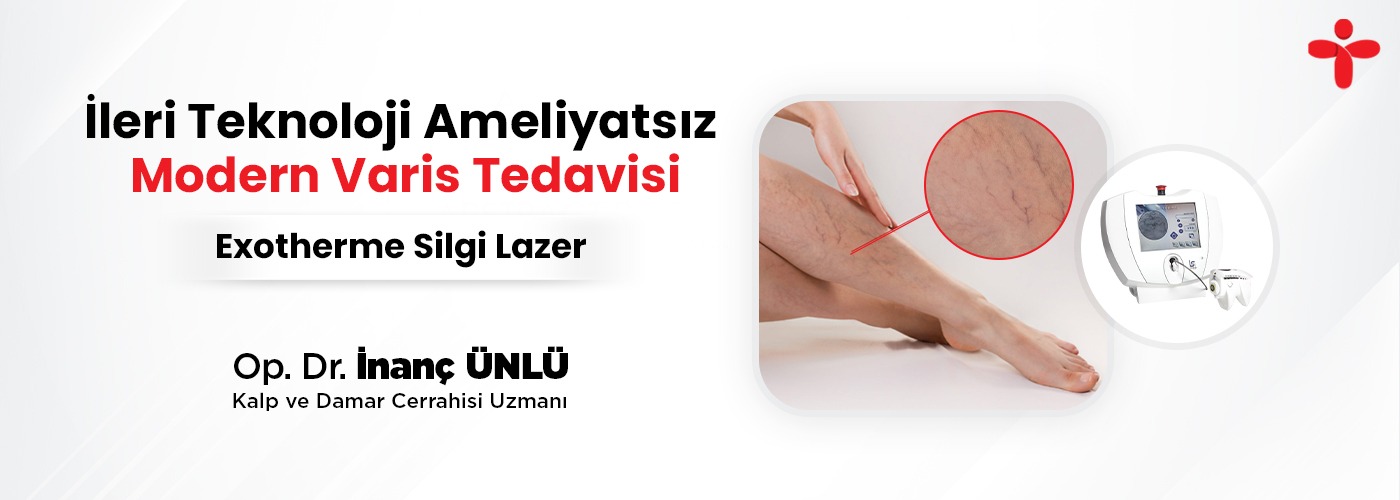 İleri Teknoloji Ameliyatsız Modern Varis Tedavisi
